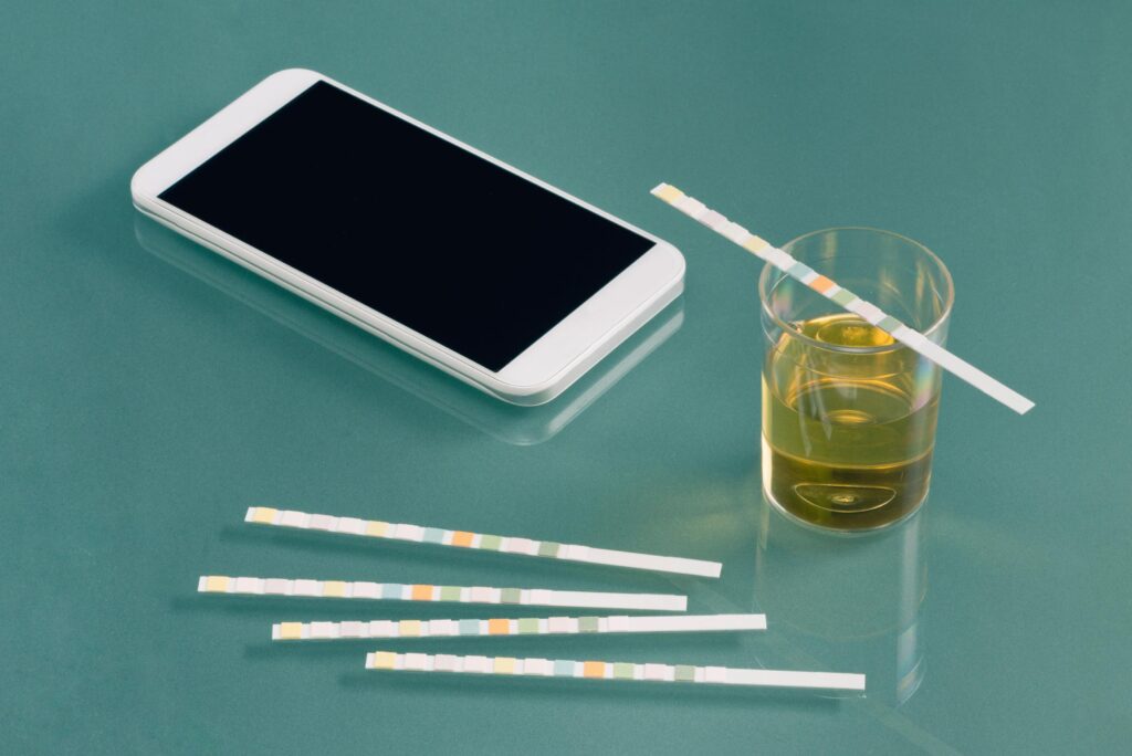 urine drug testing
